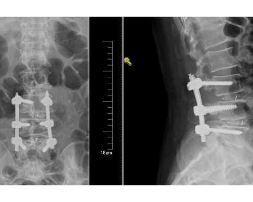 【沈阳204能做供卵试管吗】生了一个多月，终于有时间来说我生孩子的过程了（